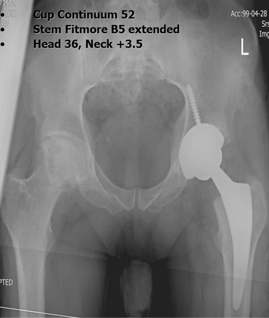 https://cdn.ncbi.nlm.nih.gov/pmc/blobs/c316/8996579/ea1d8f2411e6/13018_2022_3086_Fig3_HTML.jpg