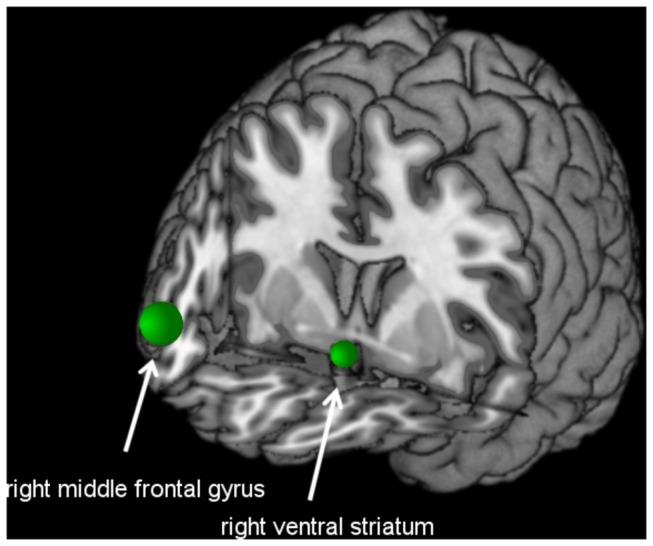 https://cdn.ncbi.nlm.nih.gov/pmc/blobs/c319/3868704/4ac6ae445b07/pone.0084565.g001.jpg