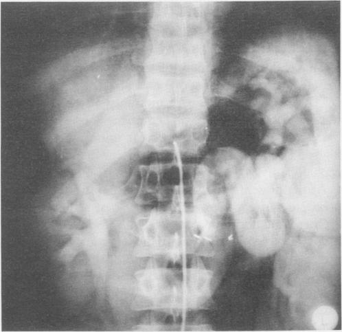https://cdn.ncbi.nlm.nih.gov/pmc/blobs/c31c/1493981/a9392f66b870/annsurg00182-0125-a.jpg