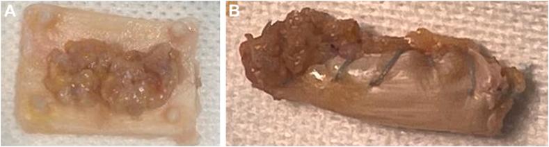 https://cdn.ncbi.nlm.nih.gov/pmc/blobs/c320/11401564/271f7319eb6b/gr5.jpg