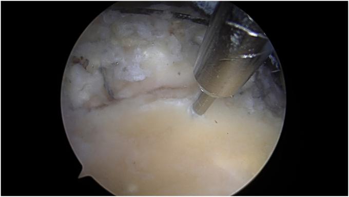 https://cdn.ncbi.nlm.nih.gov/pmc/blobs/c320/11401564/45f4740fdb95/gr9.jpg