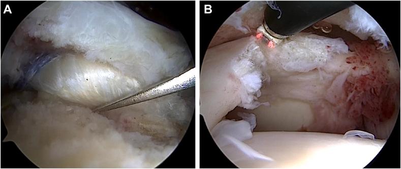https://cdn.ncbi.nlm.nih.gov/pmc/blobs/c320/11401564/aea5daa0cb65/gr2.jpg