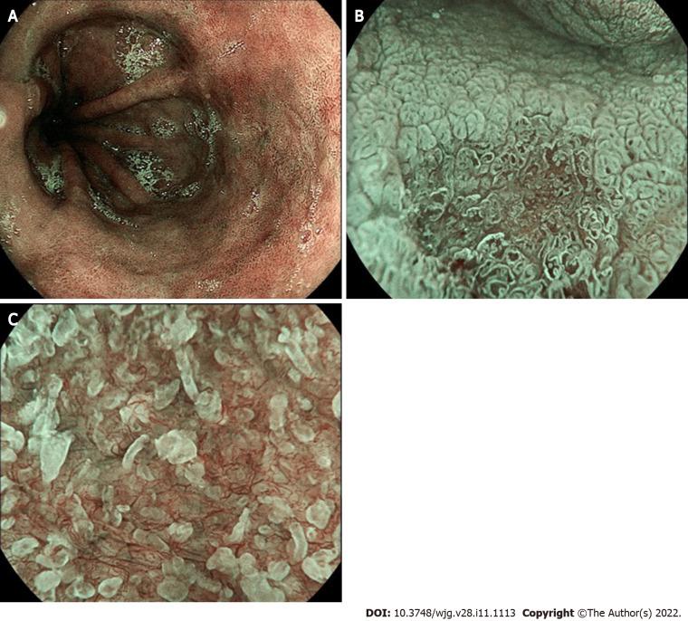 https://cdn.ncbi.nlm.nih.gov/pmc/blobs/c326/8985480/721c4fedeb2b/WJG-28-1113-g004.jpg