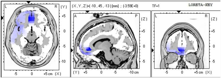 https://cdn.ncbi.nlm.nih.gov/pmc/blobs/c329/3860257/84bbb395bd38/fnagi-05-00082-g005.jpg