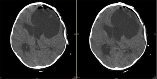 https://cdn.ncbi.nlm.nih.gov/pmc/blobs/c32a/6159100/847b836bd994/AJNS-13-800-g003.jpg