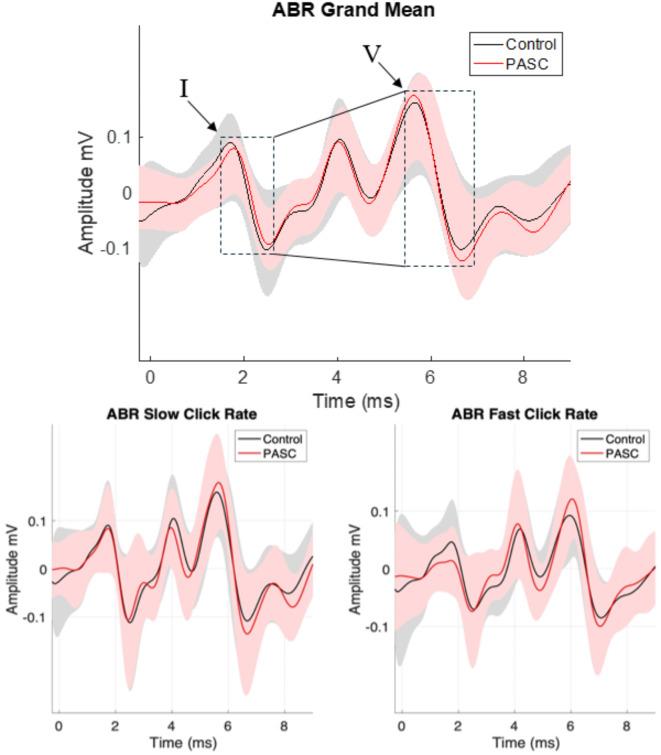 https://cdn.ncbi.nlm.nih.gov/pmc/blobs/c32c/11920441/e494344bc176/41598_2025_93664_Fig1_HTML.jpg