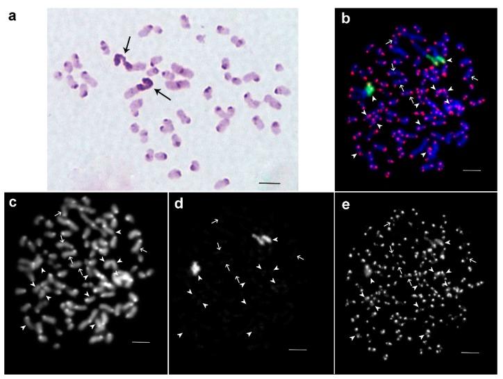 https://cdn.ncbi.nlm.nih.gov/pmc/blobs/c32c/5704240/a2676d4d76e9/genes-08-00327-g003.jpg