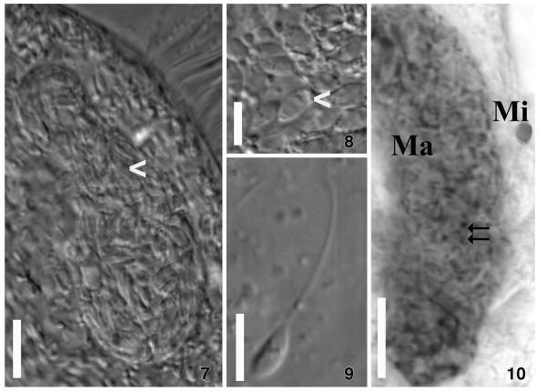 https://cdn.ncbi.nlm.nih.gov/pmc/blobs/c32d/4022238/13a7c5e2e874/1756-3305-7-203-2.jpg