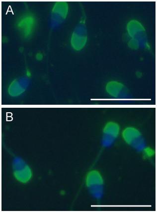 https://cdn.ncbi.nlm.nih.gov/pmc/blobs/c330/1794412/d0dbfb89602a/1477-7827-5-1-2.jpg