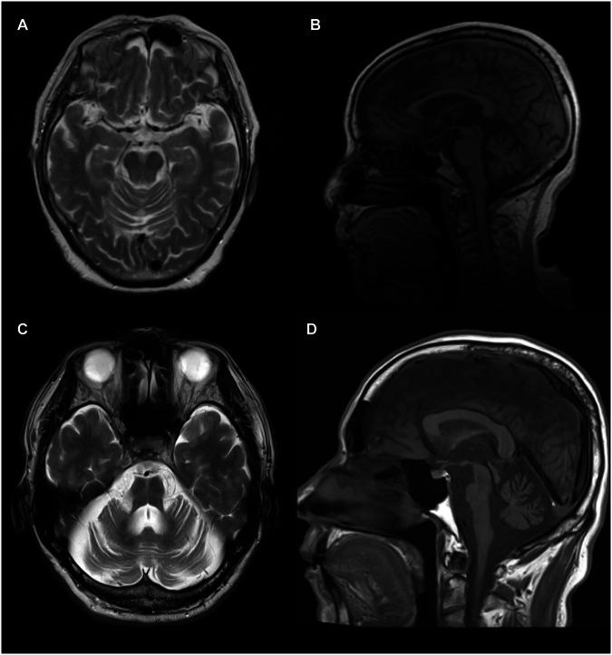https://cdn.ncbi.nlm.nih.gov/pmc/blobs/c335/11893785/1529fb25660b/41431_2024_1743_Fig3_HTML.jpg