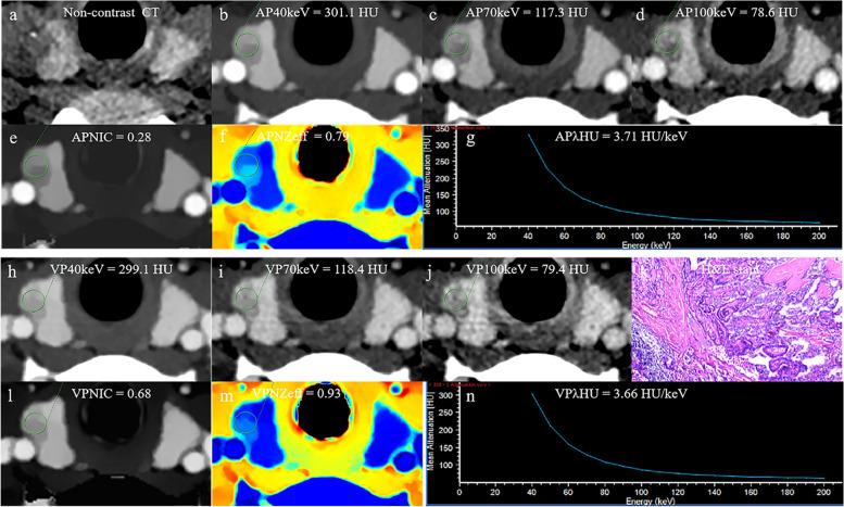 https://cdn.ncbi.nlm.nih.gov/pmc/blobs/c335/9878766/8d571252a397/40644_2023_525_Fig6_HTML.jpg