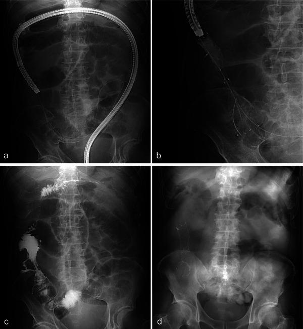 https://cdn.ncbi.nlm.nih.gov/pmc/blobs/c337/12378014/299f55e4031c/DEO2-6-e70190-g002.jpg