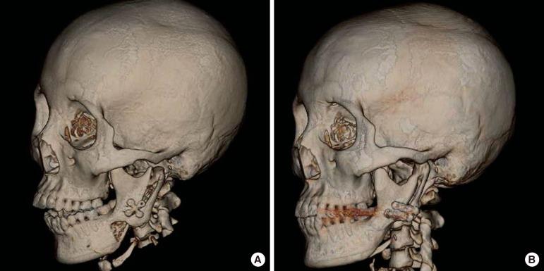https://cdn.ncbi.nlm.nih.gov/pmc/blobs/c341/3408272/60899f1cb1e2/aps-39-291-g008.jpg