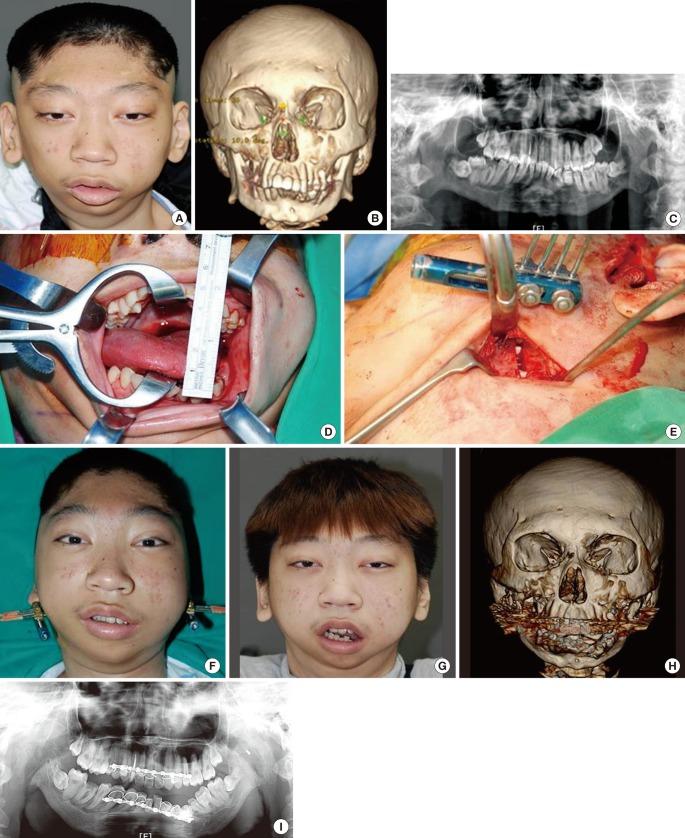 https://cdn.ncbi.nlm.nih.gov/pmc/blobs/c341/3408272/92ff7959e9ad/aps-39-291-g010.jpg