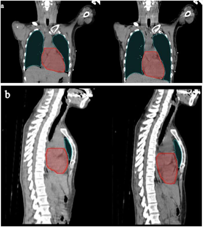 https://cdn.ncbi.nlm.nih.gov/pmc/blobs/c341/8521420/0c2bd4d4f763/10.1177_15330338211048706-fig1.jpg
