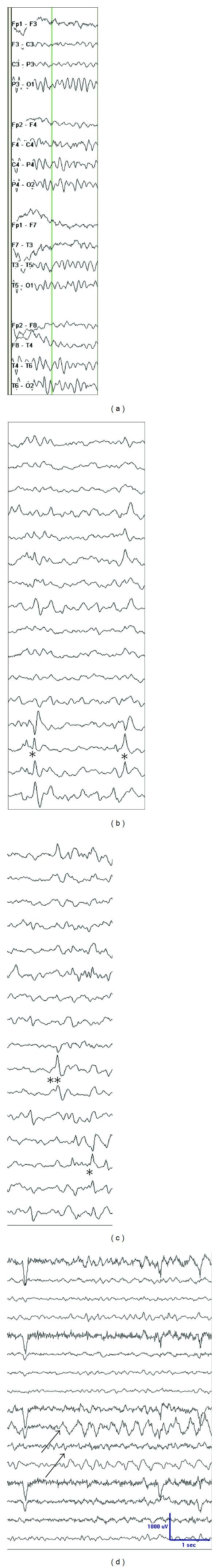 https://cdn.ncbi.nlm.nih.gov/pmc/blobs/c344/3503287/1cdb7df34321/ERT2012-204693.015.jpg