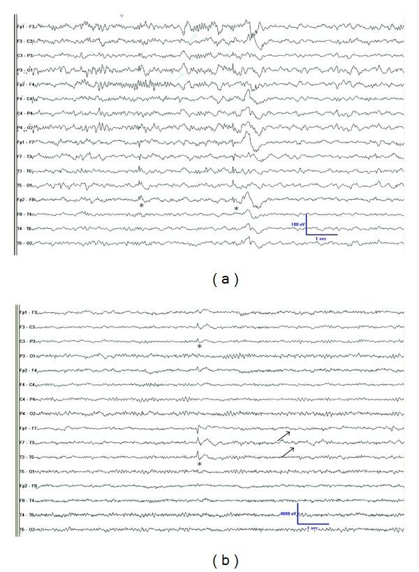 https://cdn.ncbi.nlm.nih.gov/pmc/blobs/c344/3503287/4b9dd4fc403f/ERT2012-204693.003.jpg