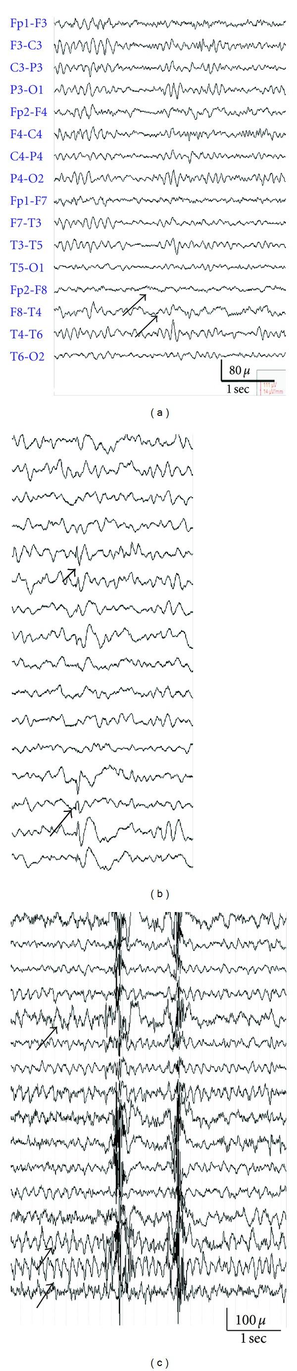 https://cdn.ncbi.nlm.nih.gov/pmc/blobs/c344/3503287/9879b36a9f4e/ERT2012-204693.007.jpg