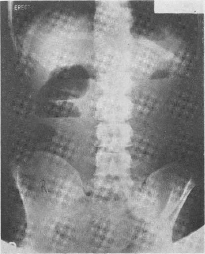 https://cdn.ncbi.nlm.nih.gov/pmc/blobs/c345/2482593/8d7f6a9c3e7f/postmedj00469-0030-b.jpg