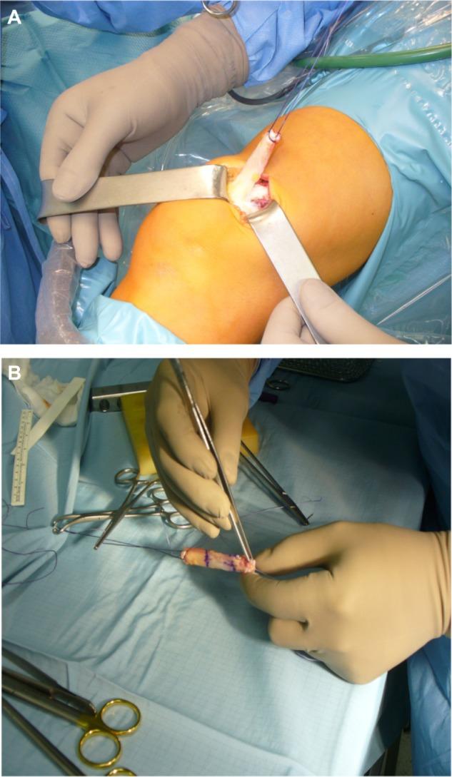 https://cdn.ncbi.nlm.nih.gov/pmc/blobs/c349/3873799/e15432561991/oajsm-4-243Fig1.jpg
