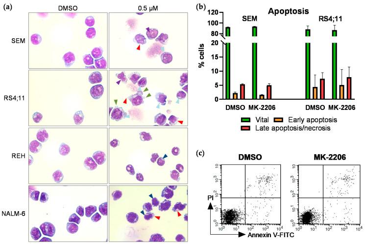 https://cdn.ncbi.nlm.nih.gov/pmc/blobs/c34d/7967241/57ec014b3e55/ijms-22-02771-g003.jpg