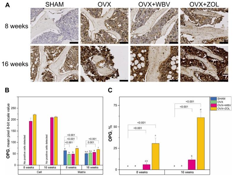 https://cdn.ncbi.nlm.nih.gov/pmc/blobs/c35a/9101134/856e2aee4928/jcm-11-02441-g004.jpg