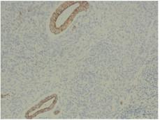 https://cdn.ncbi.nlm.nih.gov/pmc/blobs/c35b/4334994/3a28c9ad06fe/gr2.jpg