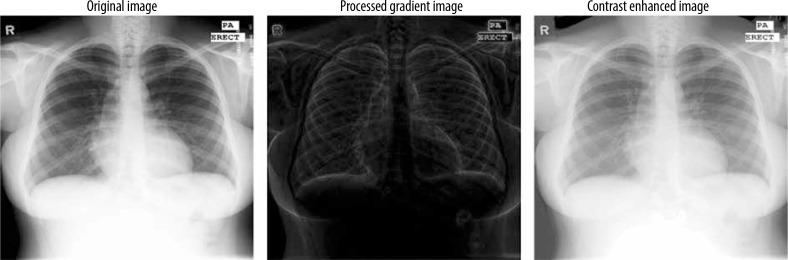 https://cdn.ncbi.nlm.nih.gov/pmc/blobs/c364/12049158/4daf88d3d463/PJR-90-200628-g002.jpg