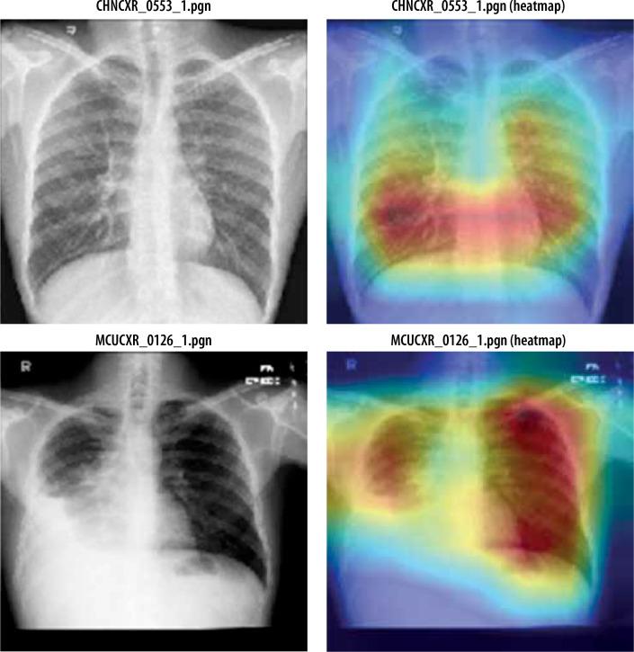 https://cdn.ncbi.nlm.nih.gov/pmc/blobs/c364/12049158/5d4925b3b949/PJR-90-200628-g011.jpg