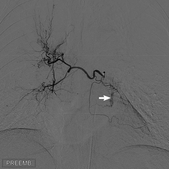 https://cdn.ncbi.nlm.nih.gov/pmc/blobs/c367/4414643/c1b7656f08f5/jkms-30-591-g004.jpg