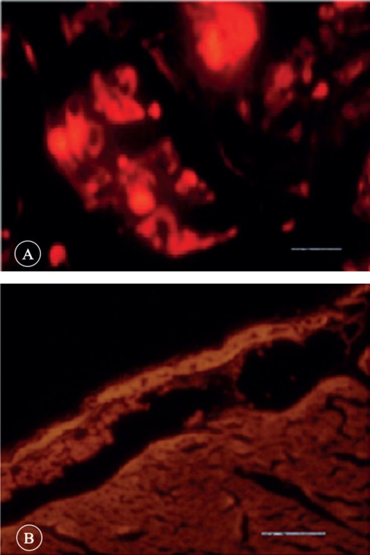https://cdn.ncbi.nlm.nih.gov/pmc/blobs/c370/5148815/0913964c4418/JTHC-11-123-g001.jpg