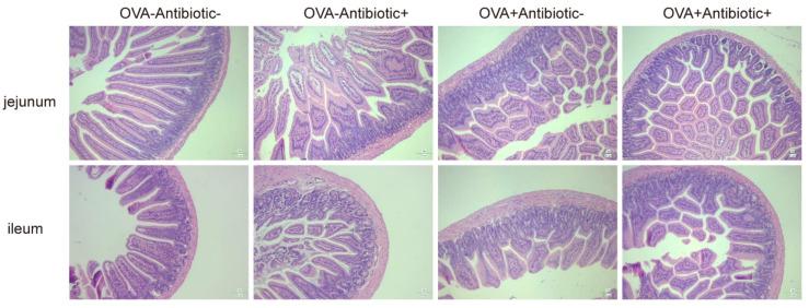 https://cdn.ncbi.nlm.nih.gov/pmc/blobs/c371/8539551/0a424d2c704a/nutrients-13-03315-g007.jpg