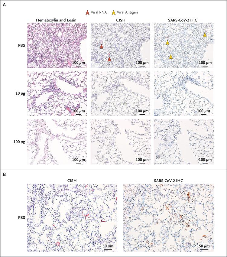 https://cdn.ncbi.nlm.nih.gov/pmc/blobs/c378/7449230/32e32c52d618/NEJMoa2024671_f4.jpg