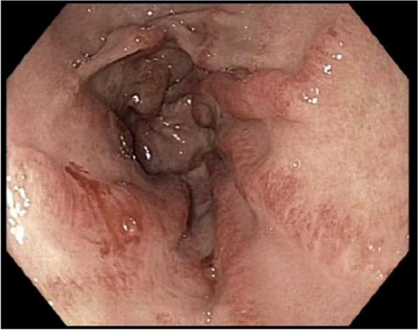 https://cdn.ncbi.nlm.nih.gov/pmc/blobs/c383/9087964/4135d53978aa/13075_2022_2790_Fig1_HTML.jpg