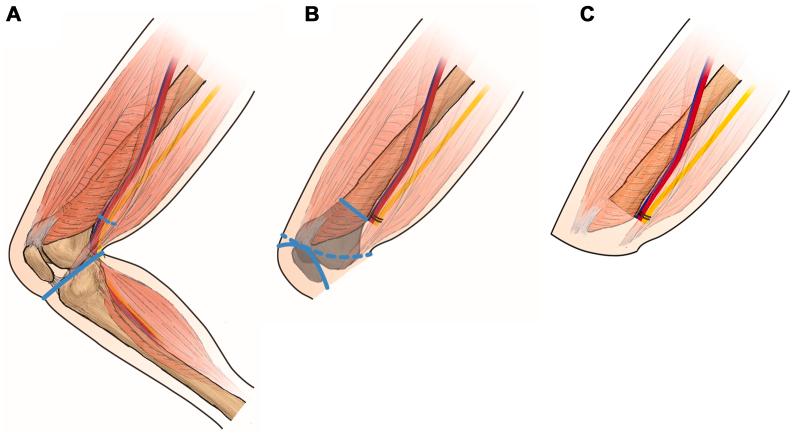 https://cdn.ncbi.nlm.nih.gov/pmc/blobs/c389/12182793/b1bd125c9dec/gr2.jpg