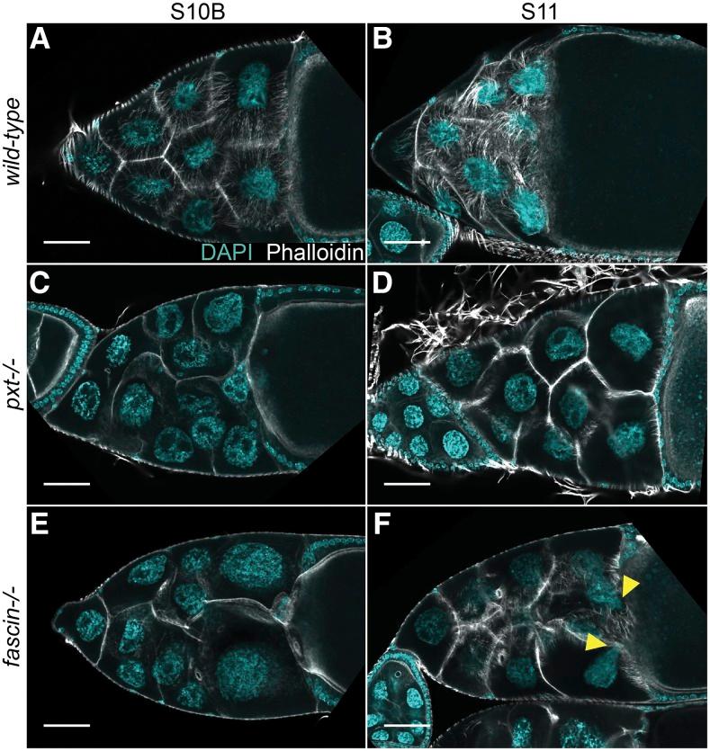 https://cdn.ncbi.nlm.nih.gov/pmc/blobs/c38a/6829128/ea93699e0967/3555f1.jpg
