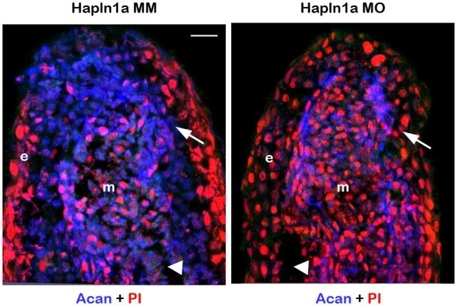 https://cdn.ncbi.nlm.nih.gov/pmc/blobs/c38b/4734779/e410fd943da6/pone.0148202.g005.jpg
