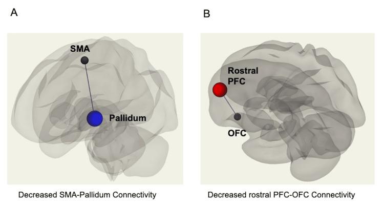 https://cdn.ncbi.nlm.nih.gov/pmc/blobs/c38f/10874683/2f541e0951b1/cureus-0016-00000052589-i02.jpg
