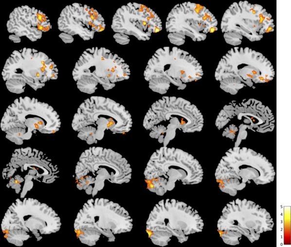 https://cdn.ncbi.nlm.nih.gov/pmc/blobs/c396/4055184/34b8316b7f85/brb30004-0337-f4.jpg