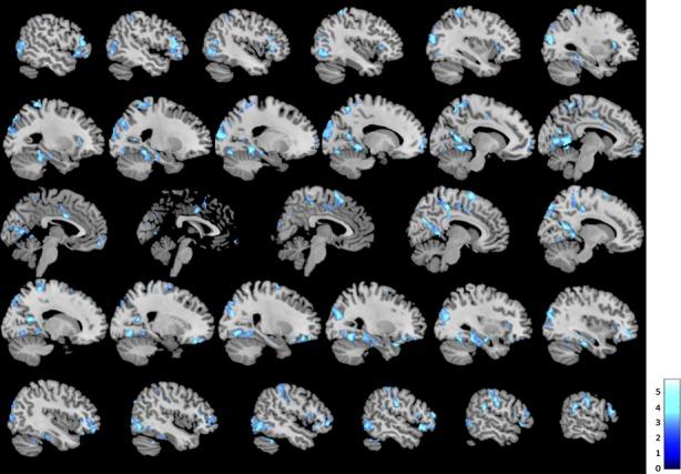 https://cdn.ncbi.nlm.nih.gov/pmc/blobs/c396/4055184/86d7f78ffe22/brb30004-0337-f2.jpg