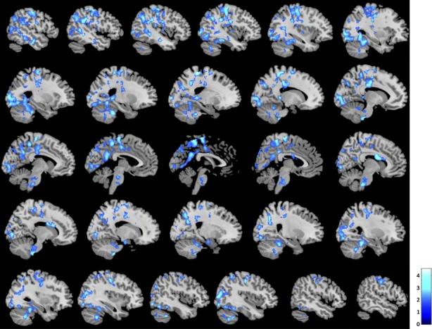 https://cdn.ncbi.nlm.nih.gov/pmc/blobs/c396/4055184/e714fcdda703/brb30004-0337-f1.jpg