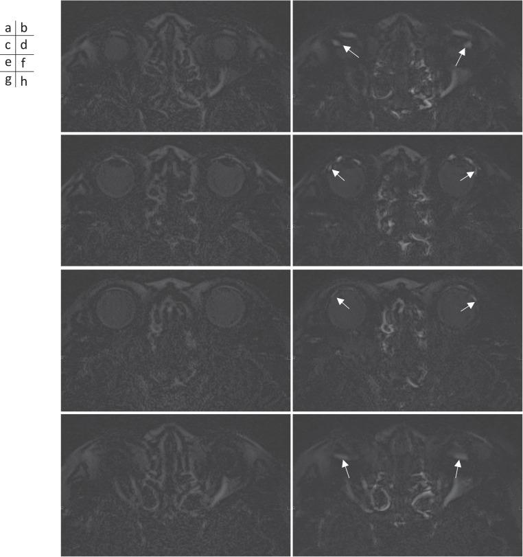 https://cdn.ncbi.nlm.nih.gov/pmc/blobs/c39a/9849422/d88b4558fa2b/mrms-22-45-g3a.jpg