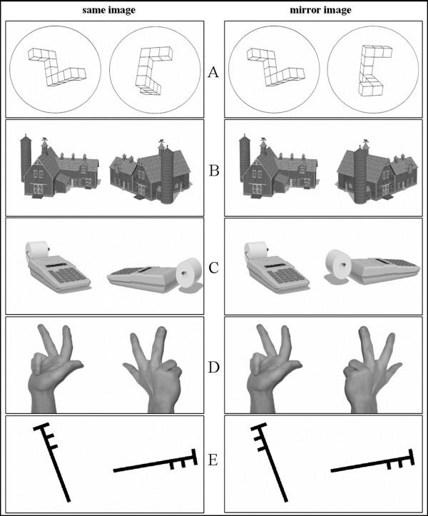 https://cdn.ncbi.nlm.nih.gov/pmc/blobs/c39c/1994952/c3c0e7045d76/1744-9081-3-38-1.jpg