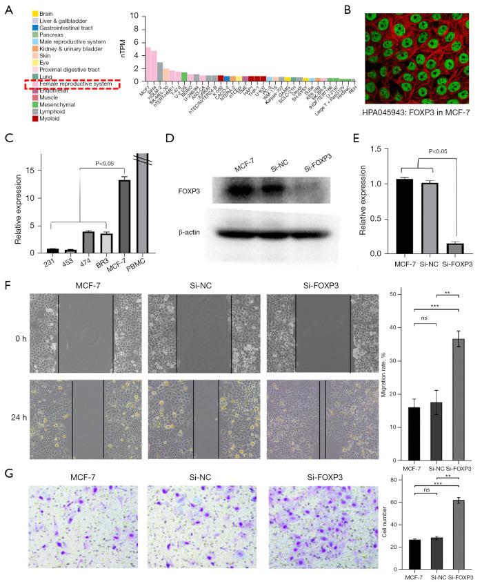 https://cdn.ncbi.nlm.nih.gov/pmc/blobs/c3b3/9372690/64f8af711ee8/atm-10-14-801-f8.jpg