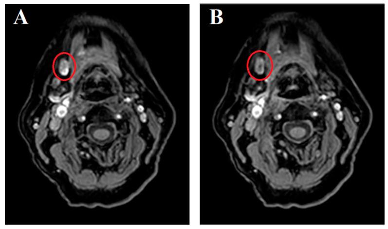 https://cdn.ncbi.nlm.nih.gov/pmc/blobs/c3b7/11642361/43cc01f86fb6/jcm-13-07052-g003.jpg