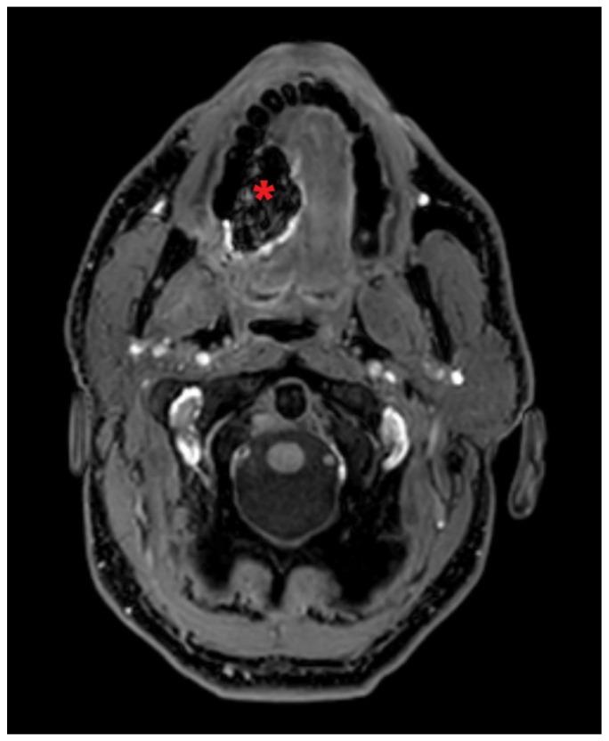 https://cdn.ncbi.nlm.nih.gov/pmc/blobs/c3b7/11642361/af20f32c7215/jcm-13-07052-g004.jpg