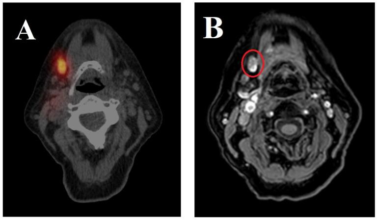 https://cdn.ncbi.nlm.nih.gov/pmc/blobs/c3b7/11642361/becc2a396ed1/jcm-13-07052-g001.jpg
