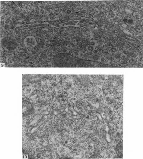 https://cdn.ncbi.nlm.nih.gov/pmc/blobs/c3b9/1235598/1bd16a8a21b5/janat00360-0096-a.jpg