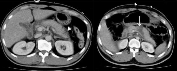 https://cdn.ncbi.nlm.nih.gov/pmc/blobs/c3b9/3022694/f75a64aad99b/1752-2897-5-1-2.jpg