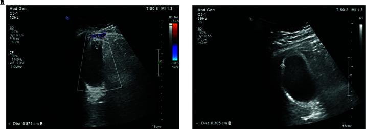 https://cdn.ncbi.nlm.nih.gov/pmc/blobs/c3bb/11697797/15692899a73e/LS-JSLS240023F003.jpg
